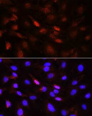 Immunocytochemistry/ Immunofluorescence: Jak1 [p Tyr1022, p Tyr1023] Antibody - BSA Free [NBP3-05436]